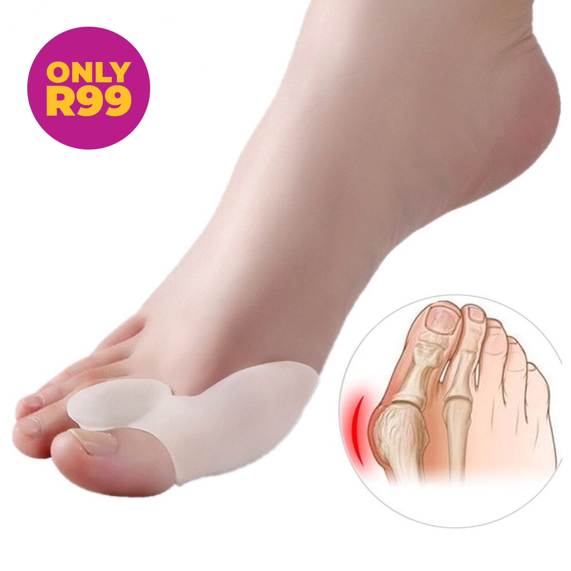 Pack of 2 Soft Gel Bunion Corrector and Toe Supports